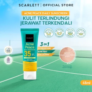 SCARLETT Acne Peace Daily Sunscreen SPF 35 PA++++ – Sunscreen for Acne-Prone Skin, In Vivo Tested, Non-Acnegenic Tested, Non-Comedogenic Tested, Fights Acne