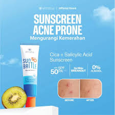 Emina Sun Battle SPF 50 PA ++++ Cica Acne Fighter Sunscreen 30 ml - Image 3