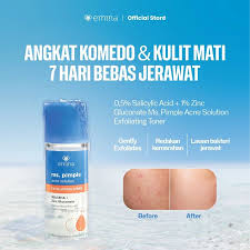 Emina Ms. Pimple Acne Solution Exfoliating Toner 100 ml